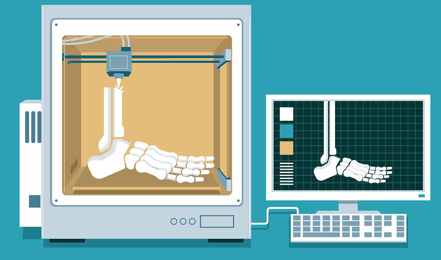 An illustration shows a 3D printer creating a foot and lower leg for organ reconstruction.