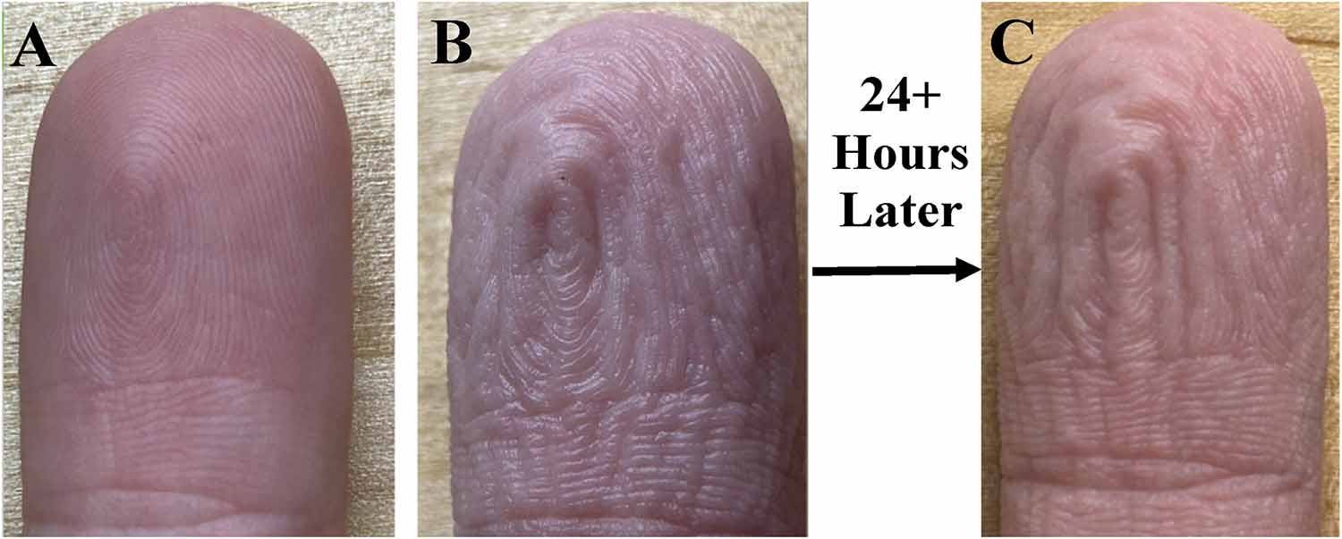 A dry, unwrinkled finger; the same finger with wrinkles; and the same finger with wrinkles and a label saying the photo was taken 24 hours later.