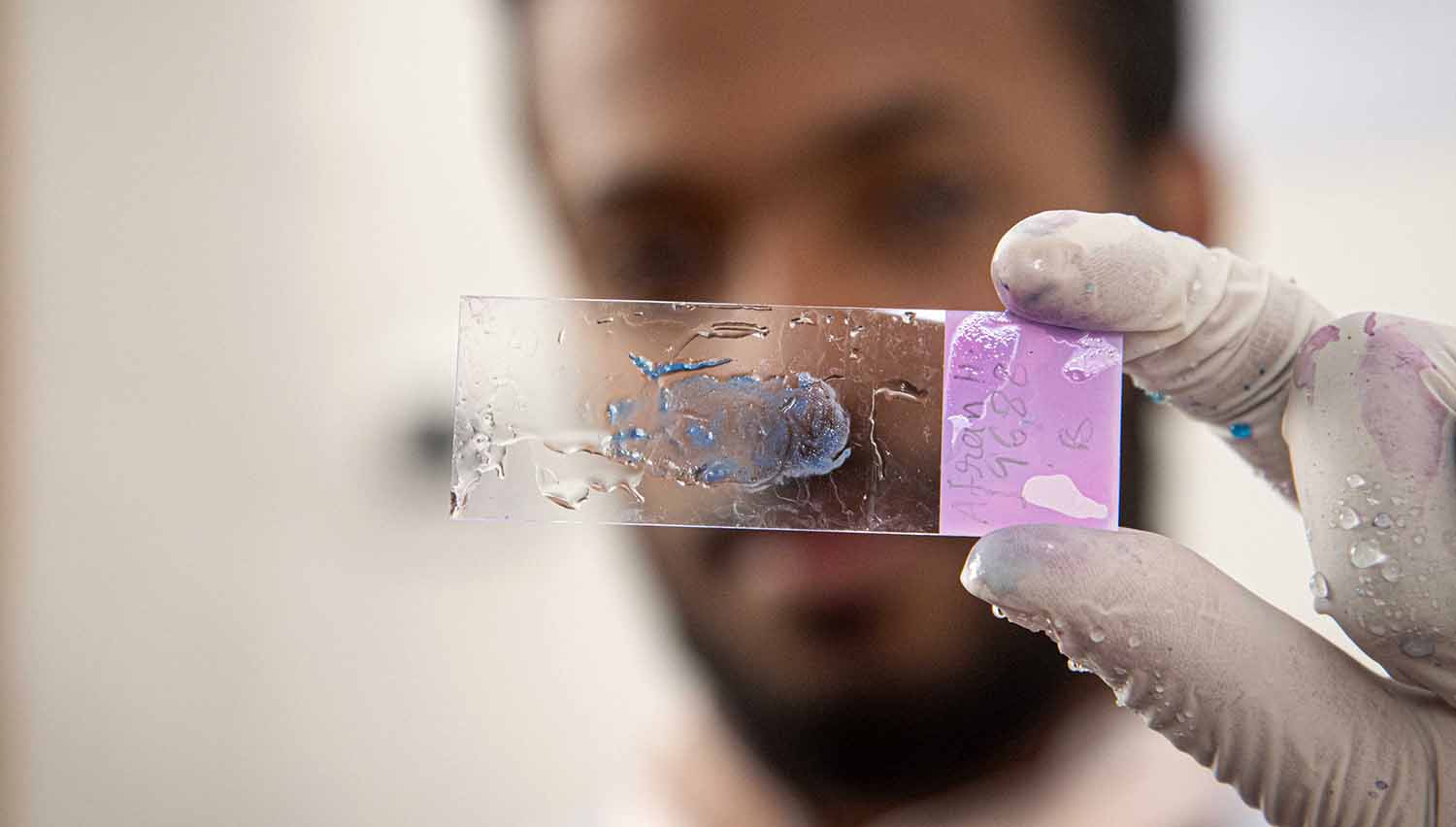 A man wearing a rubber glove holds up a slide containing a saliva sample.